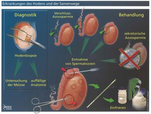 Erkrankungen des Hodens und der Samenwege