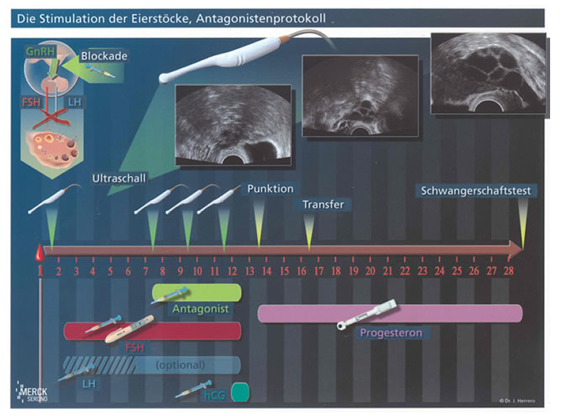 Hormone stimulation ‘antagonist protocol’